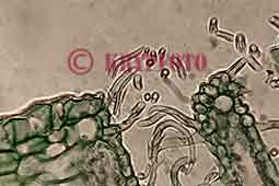 mikroskpisk bild av ett neriumblad